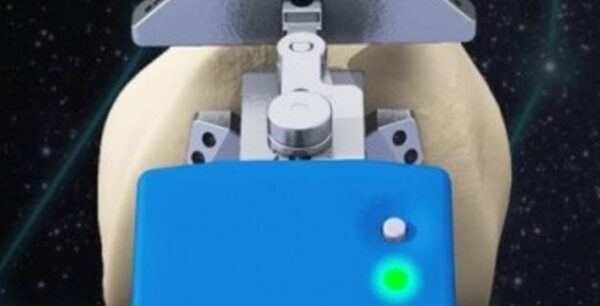 Νέο γόνατο κατά παραγγελία- Θεραπεία της αρθρίτιδας του γόνατος