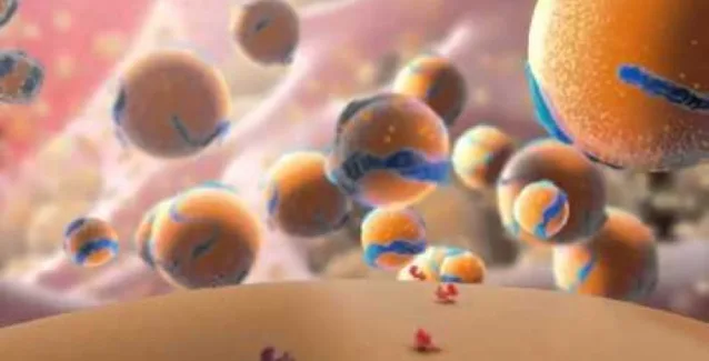 Ελπιδοφόρα μηνύματα για τους ασθενείς με οικογενή υπερχοληστερολαιμία