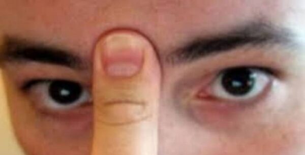 Εξαιρετικά εύκολη μέθοδος: Καθαρίστε τα Ιγμόρεια σας σε 30 δευτερόλεπτα!