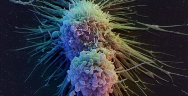 Ιός της ιλαράς στη μάχη κατά του καρκίνου