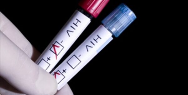 Φάρμακο κατά του αλκοολισμού «ξετρυπώνει» τον κρυμμένο στα κύτταρα ιό HIV του AIDS