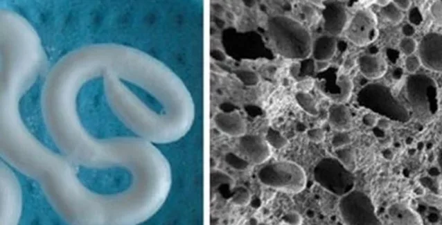 Βρέθηκε φόρμουλα ενέσιμου αφρού που επιδιορθώνει τα εκφυλισμένα οστά