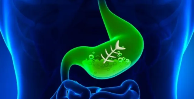 Πως θα αντιμετωπίσετε την καούρα με φυσικό ρόφημα