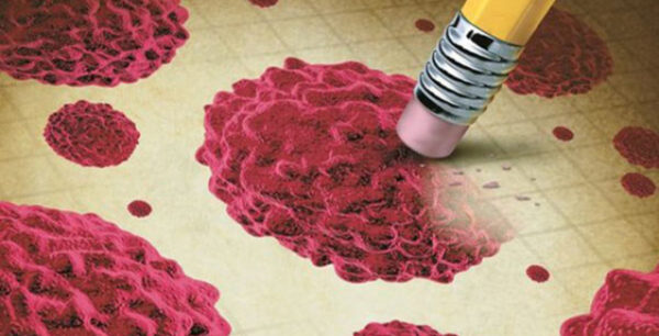 Επτά συμπτώματα που δείχνουν καρκίνο και δυστυχώς τα αγνοούμε