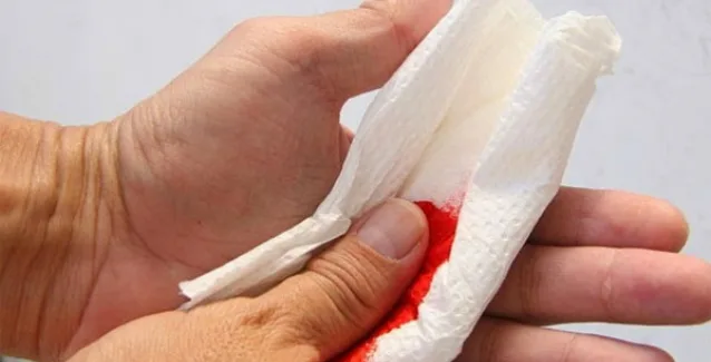 Κόψιμο στο δέρμα: Τι να κάνετε για να μην μολυνθεί