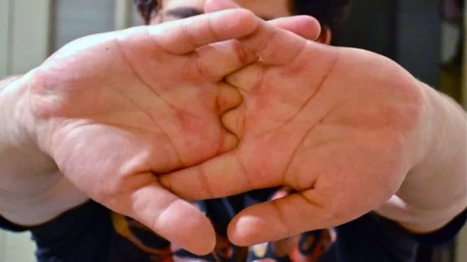 Δείτε τι μπορεί να προκαλέσει το “κράκ” που κάνουμε με τα δάχτυλα μας…