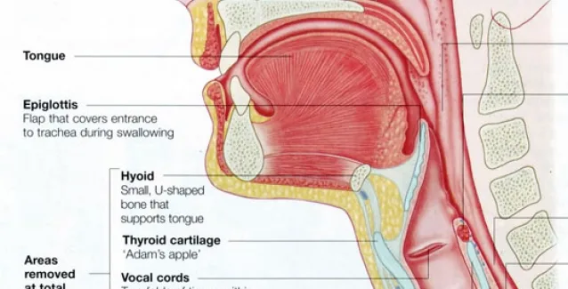 Καρκίνος λάρυγγα: ύπουλος εχθρός που απαιτεί επαγρύπνηση