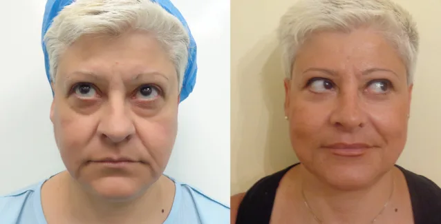 Ημερίδα Live Face & Breast Makeover