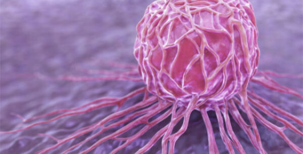 Καρκίνος μαστού: Νέα ανακάλυψη-κλειδί για την αποτροπή των μεταστάσεων!