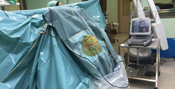 ΑΠΙΣΤΕΥΤΟ: Ελληνες γιατροί αφαίρεσαν όγκο από τον εγκέφαλο με τον ασθενή ξύπνιο! (Βίντεο)