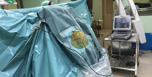 ΑΠΙΣΤΕΥΤΟ: Ελληνες γιατροί αφαίρεσαν όγκο από τον εγκέφαλο με τον ασθενή ξύπνιο! (Βίντεο)