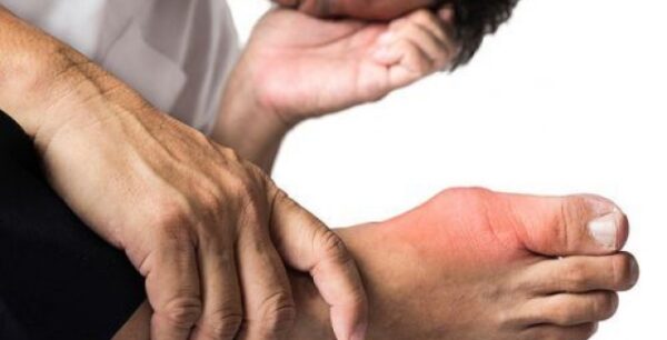 Ουρικό οξύ: Αν έχετε αυτά, κάντε εξετάσεις!