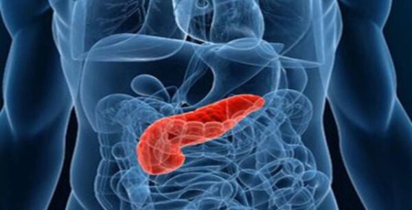 Έρευνα: Τί αυξάνει τον κίνδυνο εμφάνισης καρκίνου στο πάγκρεας
