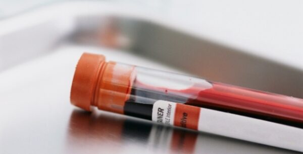 Τεστ αίματος για την έγκαιρη διάγνωση του Πάρκινσον