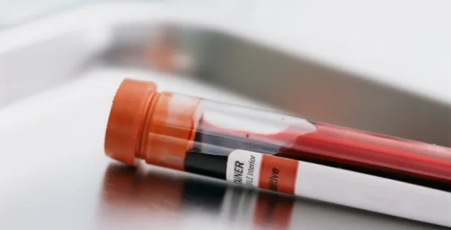 Τεστ αίματος για την έγκαιρη διάγνωση του Πάρκινσον