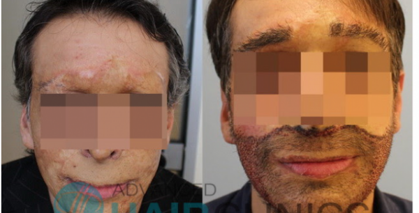 ΝΕΟ ΠΡΟΣΩΠΟ ΣΕ 34ΧΡΟΝΟ ΔΗΜΙΟΥΡΓΗΣΑΝ ΕΛΛΗΝΕΣ ΕΠΙΣΤΗΜΟΝΕΣ