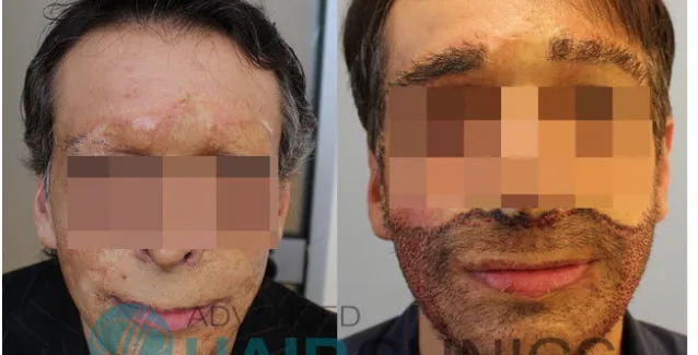 ΝΕΟ ΠΡΟΣΩΠΟ ΣΕ 34ΧΡΟΝΟ ΔΗΜΙΟΥΡΓΗΣΑΝ ΕΛΛΗΝΕΣ ΕΠΙΣΤΗΜΟΝΕΣ