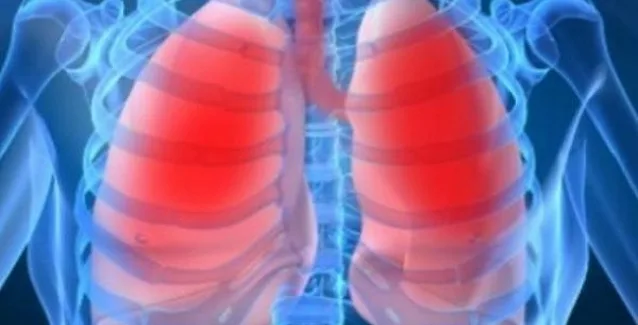 Βρογχίτιδα: Πώς να την ξεπεράσετε με απλές επιλογές στο σπίτι