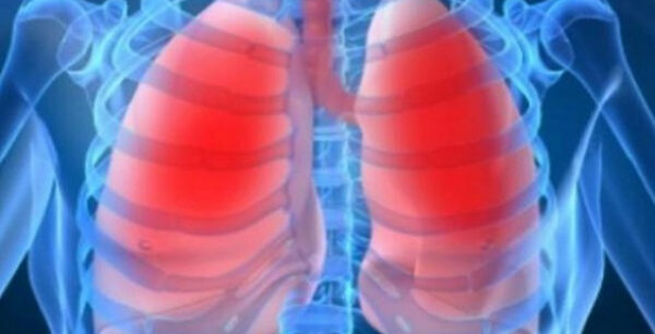 Πνευμονική εμβολή: Τι γίνεται αν δεν μπορείτε να πάρετε βαθιά ανάσα