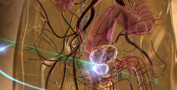 Καρκίνος του προστάτη: Αυτά είναι τα πρώιμα συμπτώματα