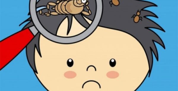 Ψείρες: Πώς θα απαλλαγείτε από την βασανιστική φαγούρα