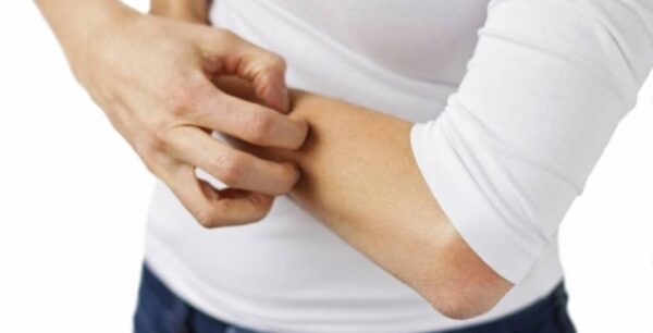 Παγκόσμια Ημέρα Ψωρίασης: Ελπίδα, Δράση, Αλλαγή για εκατομμύρια ανθρώπους