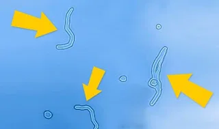 Τί είναι ΑΥΤΑ τα σημάδια που βλέπετε καμιά φορά να… αιωρούνται στα μάτια σας (ΒΙΝΤΕΟ)