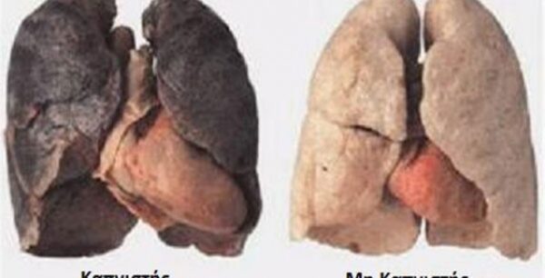 Διώξτε τη νικοτίνη με φυσικό τρόπο από τον οργανισμό σας