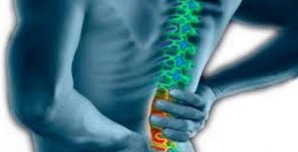 Τι είναι η κήλη μεσοσπονδύλιου δίσκου; Συμπτώματα