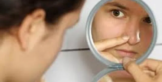 Τι δείχνουν τα σπυράκια ανάλογα με το σημείο που βγαίνουν