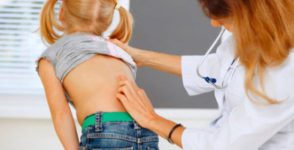 Σκολίωση: Τα 5 σημεία που πρέπει να ελέγχουν γονείς και δάσκαλοι