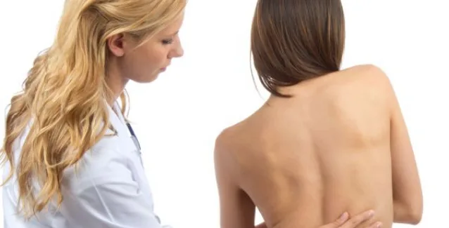 Πού οφείλεται η σκολίωση;