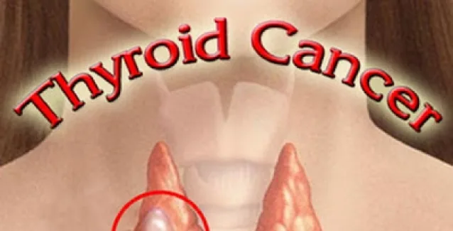 Ποια είναι τα συμπτώματα και ποιες οι αιτίες που εκδηλώνει καρκίνο ο θυρεοειδής;