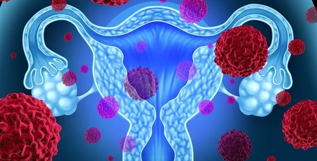 Αποτελεσματικότερες κρίνονται οι νέες τεχνικές εξέτασης για τον καρκίνο του τραχήλου της μήτρας
