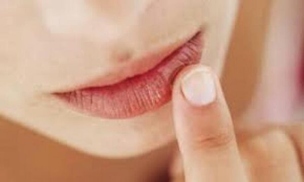 Χείλη που “σκάνε” το χειμώνα; Πρόλαβέ τα με αυτούς τους 5 τρόπους