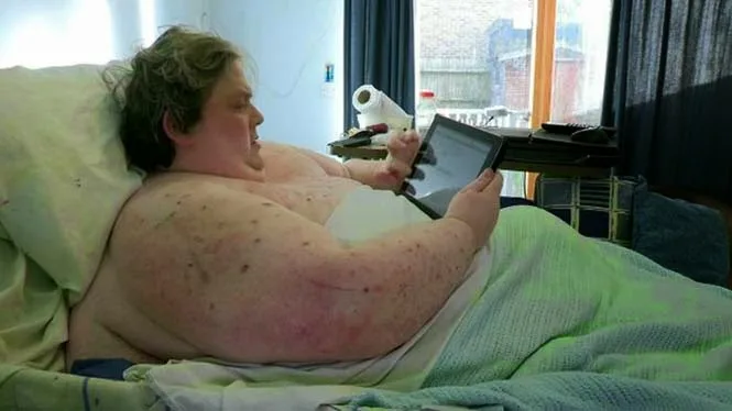 Εικόνες που προκαλούν σοκ! Δείτε πως είναι οι ακτινογραφίες ενός ανθρώπου 445 κιλών [photos + video]