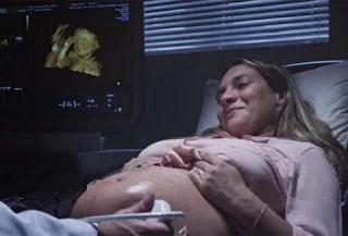 Απίστευτα ΣΥΓΚΙΝΗΤΙΚΟ! Δείτε τι κάνει ο γιατρός για να “δει” μία τυφλή έγκυος το μωρό της [video]