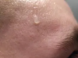 Tι πρέπει να κάνετε για να μην ιδρώνετε τόσο το καλοκαίρι!