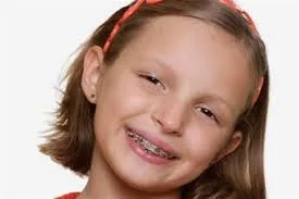 Μήπως το παιδί χρειάζεται σιδεράκια;