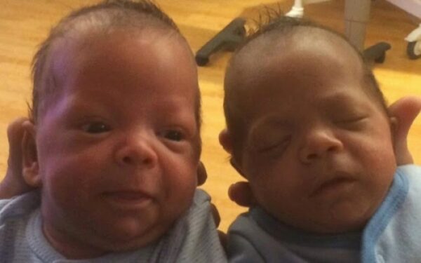 Δίδυμα γεννήθηκαν με διαφορά μιας….εποχής! [video]