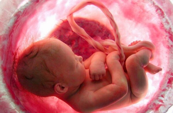 ΑΠΙΣΤΕΥΤΟ ιατρικό θαύμα – Μωρό γεννήθηκε δύο φορές! [video]