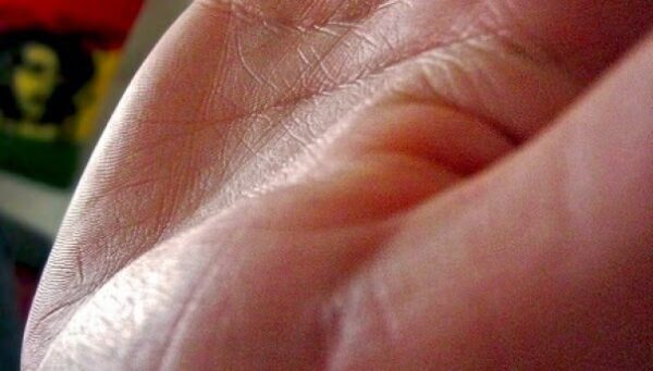 Γιατί οι παλάμες μας έχουν γραμμές;