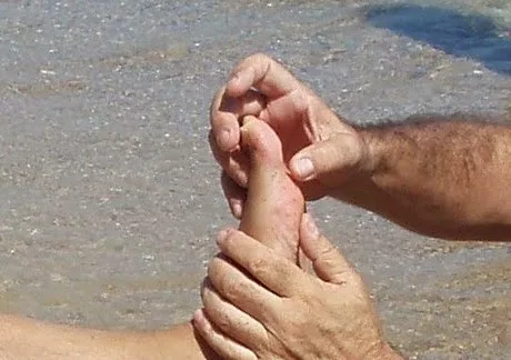 Τι να κάνετε αν πατήσετε αχινό…