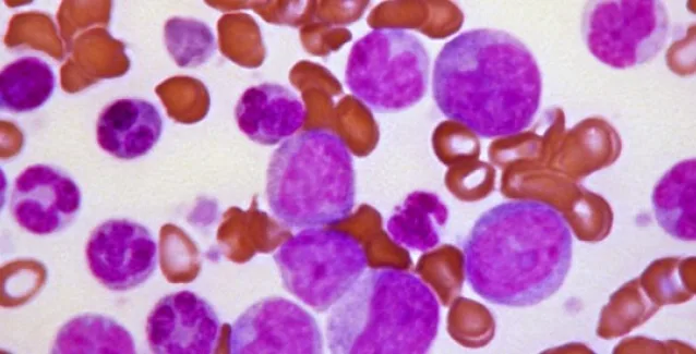 Νέο φάρμακο κατά ποικίλων μορφών καρκίνου και στο 4ο στάδιο