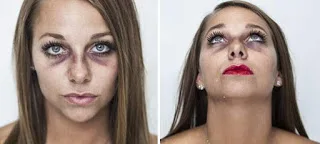 Το πρόσωπο της βίας: 27χρονη έγινε viral όταν ανέβασε πορτρέτο της μετά από κακοποίηση ~ εικόνες