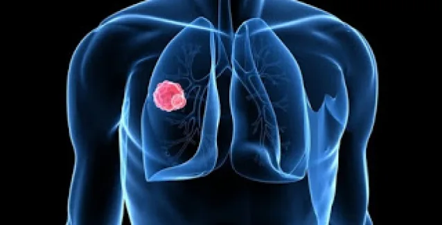 Δραματική πρόβλεψη: Μέσα σε 15 χρόνια οι θάνατοι από καρκίνο θα διπλασιαστούν