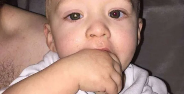 Μπορείτε να διακρίνετε τον καρκίνο στο μάτι αυτού του παιδιού;