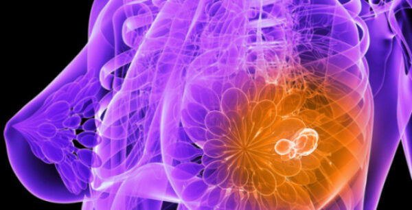 Καρκίνος του μαστού: Τι πρέπει να τρώει η γυναίκα από την εφηβεία