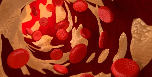 Χοληστερόλη LDL, HDL, VLDL, ολική: Ποιες είναι οι φυσιολογικές τιμές