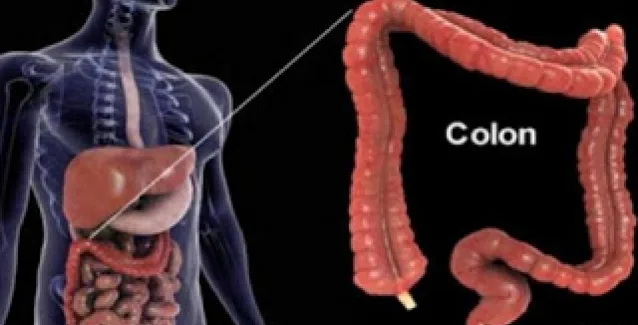 Ο θάνατος αρχίζει από το Παχύ Έντερο: Πως θα καταλάβετε, ότι κάτι δεν πάει καλά